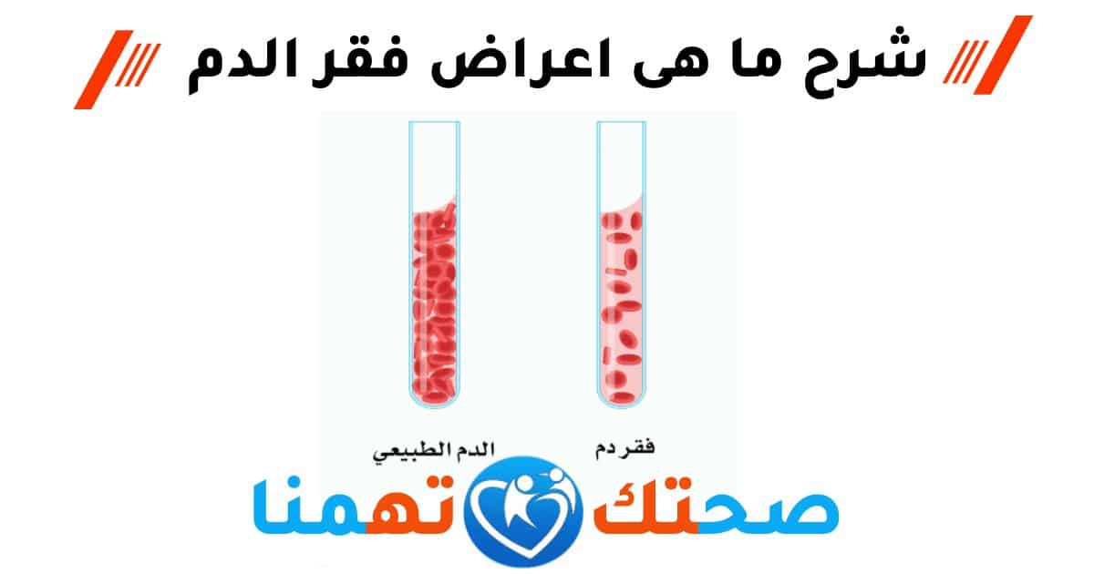 اعراض فقر الدم | متى يكون فقر الدم خطير ؟