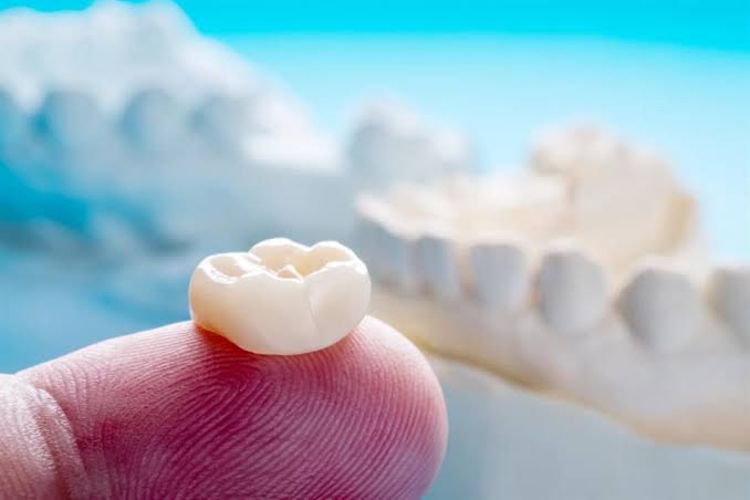 سقوط حشوة الأسنان: أسبابه، عواقبه، وكيفية التعامل معه