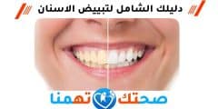 تبييض الأسنان : دليلك الشامل لابتسامة مشرقة
